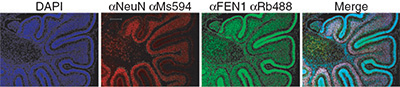 FEN1 visualization